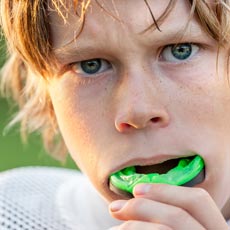 5 Facts about Your Sports Mouth Guard Dentist Troy, MI